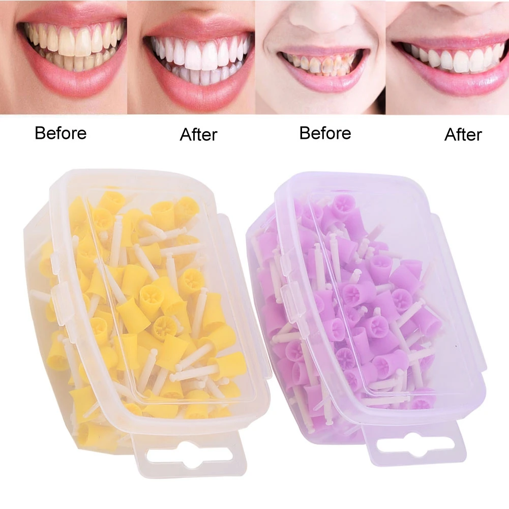 100 Pieces/Set Teeth Polishing Rubber Polishing Cups Tooth Stains Removal Whitening Dentist Tools Dental Oral Cleaning