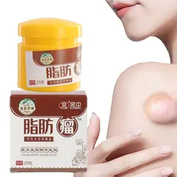 20G Lipoma Removal Cream The Whole Body Multiple Subcutaneous Conditioning Cream Eliminate Tumor Removal Ointment