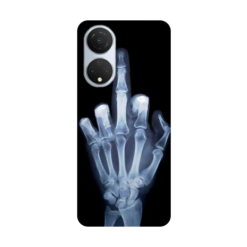 สำหรับ Honor X7เคสหลังซิลิโคนนิ่มลายฟุตบอลสำหรับ Honor X7 x 7 CMA-LX2 CMA-LX1 CMA-LX3ฝาครอบโทรศัพท์ HonorX7 ETUI fundas