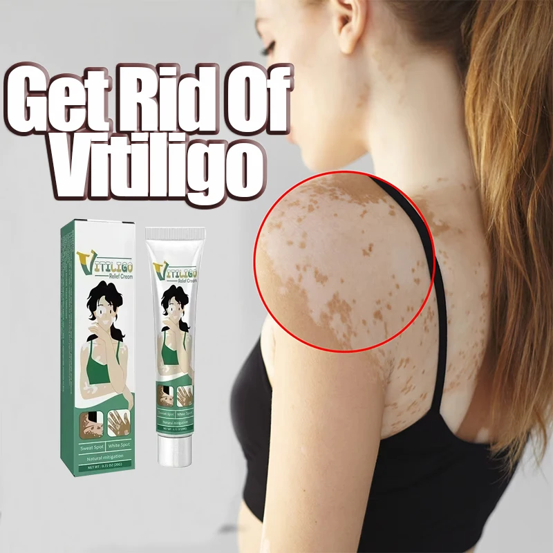 

Vitiligo Ointment Ringworm Effectively Remove White Spot Removal Skin Vitiligo Eliminate Vitiligo Body Skin Care