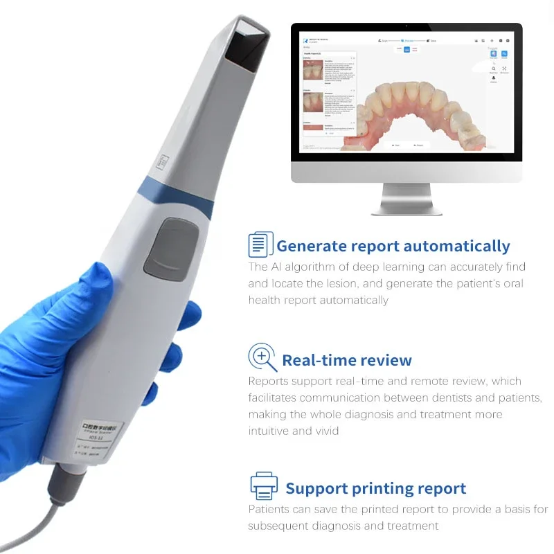 Fully automatic AI Autoclavable 3D Open system dentals scanner intraoral with software for dentists dentals laboratory andclinic