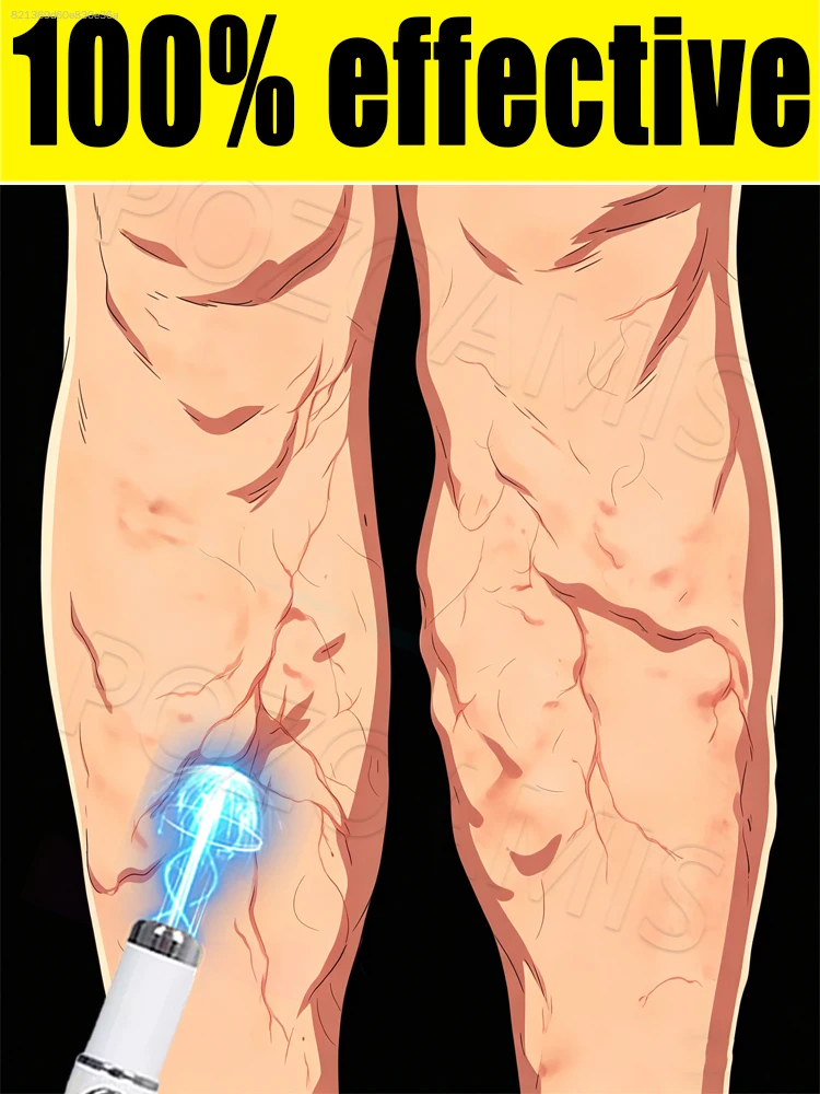 100% effective, blue light pen for leg massage