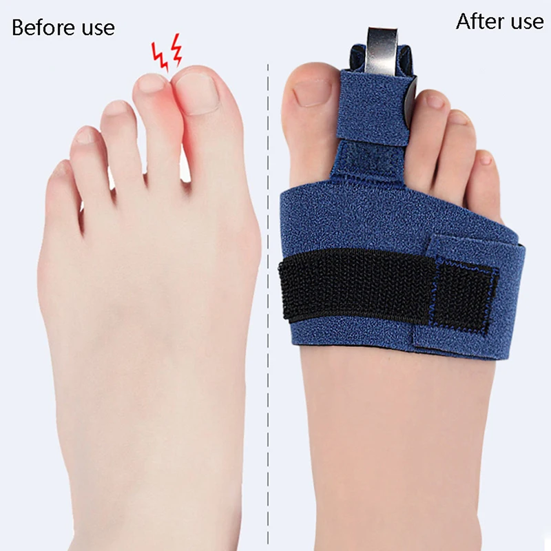 1Pc Toe Corrector Toe Fracture Fixator Orthotics Feet Bone Thumb Adjuster Correction Soft Pedicure Socks Bunion Straightener