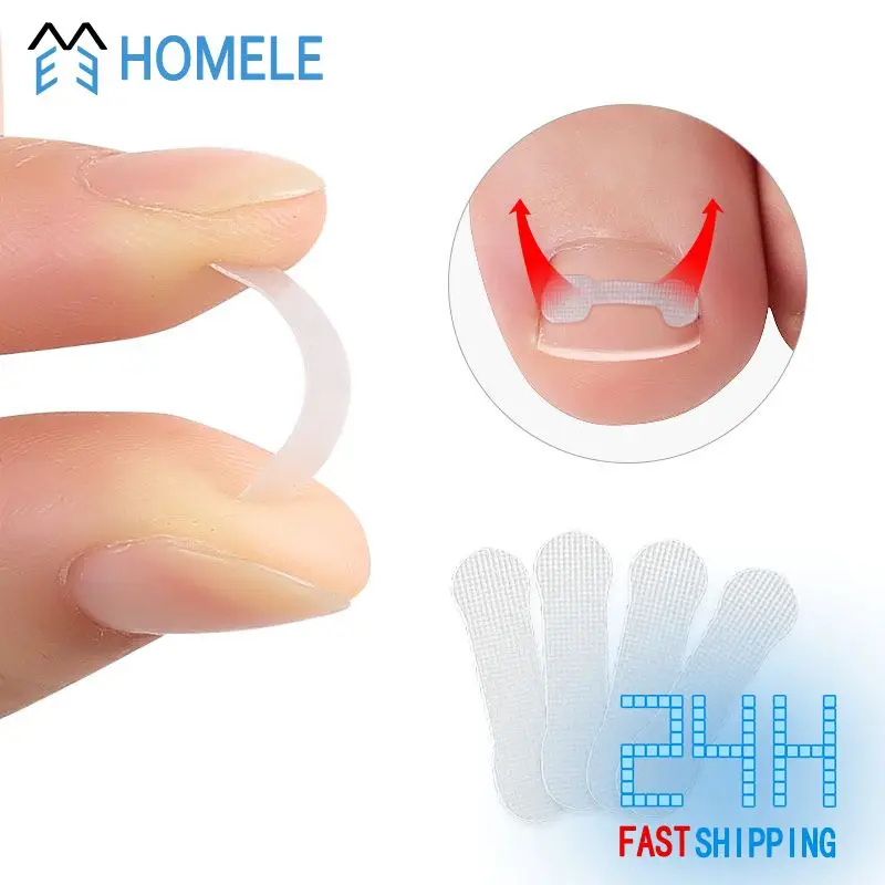 Kit Durable Easy-to-use Professional Revolutionary Versatile Game-changer Ingrown Toenail At Home Popular