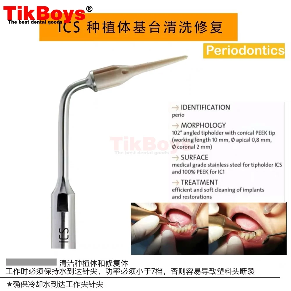 Dental Scaler Tip Periodontal Implant Cleaning P90 PD90 P94 P95 P96R P96L ICP Fit EMS Woodpecker Satelec DTE NSK Ultrasonic Tool