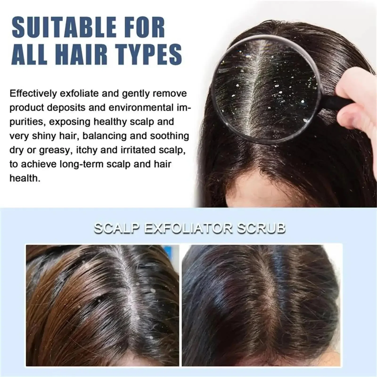 Thumbnail 4 - #34 Compare Scrubs Treatments Before You Buy