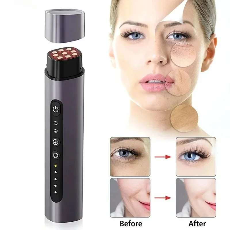 New Multi pole Imported Beauty Device EMS Microcurrent Lifting, Tightening, Light Line Photon Rejuvenation Device Pulse