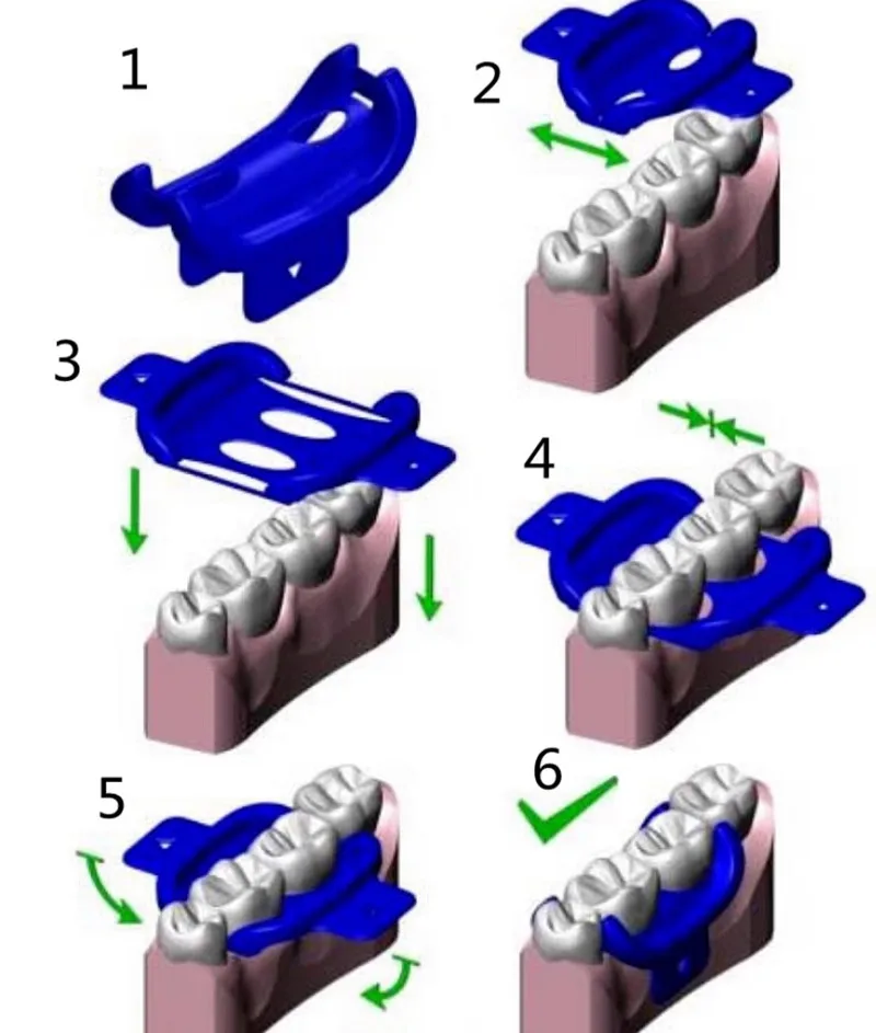 Dental Mini Dam MiniDam Rubber Dam Clamp Holder Dental Silicone Rubber Dam Clamp Clip Dental Silicon Clips Autoclavable