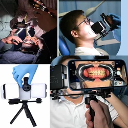 Dental Mobile Phone Photography Fill Light LED Oral Filling Lamp Dentist Treatment Photo Video Flashlight for Many Case Using