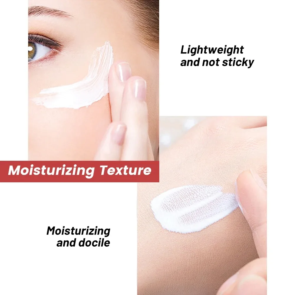 Powerful Whiten Freckle Cream Brighten Face Eliminates Dark Face Spot Melasma Melanin Pigmentation Moisturize Skin Care Cream