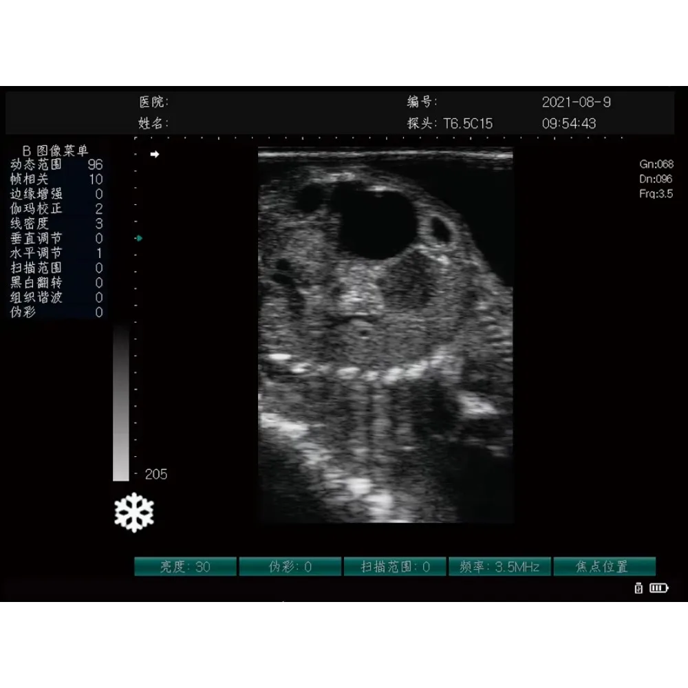Human medical black and white ultrasound machine, black and white ultrasound machine price, portable veterinary scanner