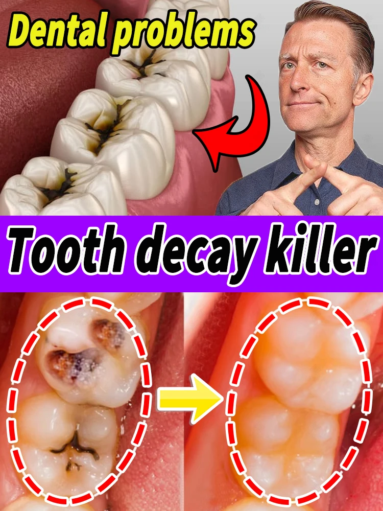 Repairing decayed teeth