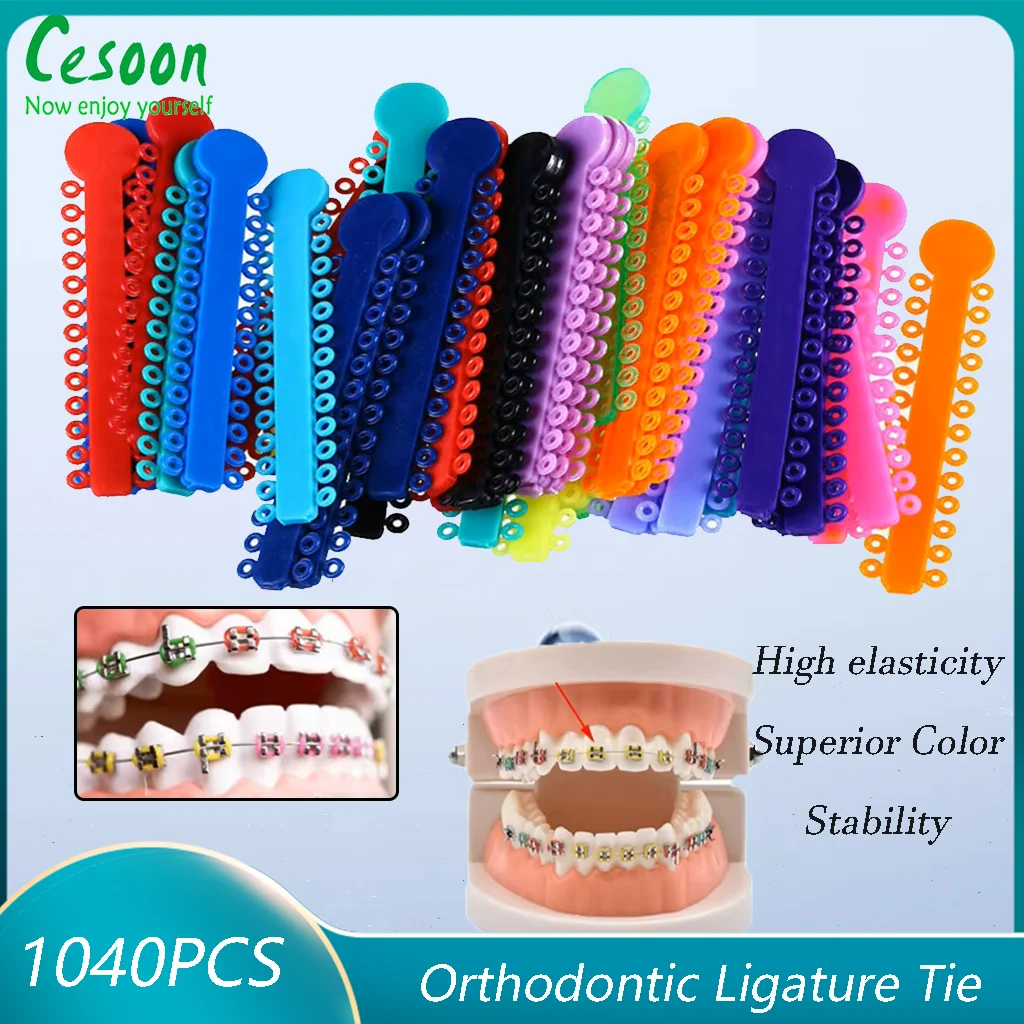 1040Pcs Dental Orthodontic Ligature Ties Elastic Multicolor Plastic Band For Healthy Teeth Tool Oral Care Dentist Ortho Material