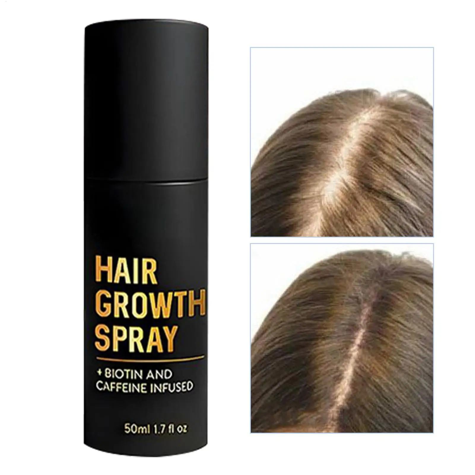 Hair Growth Spray for Men 50ml Thicker Mist Frizz Control Spray for Thickening Health Booster Scalp Care Frizz Control Home