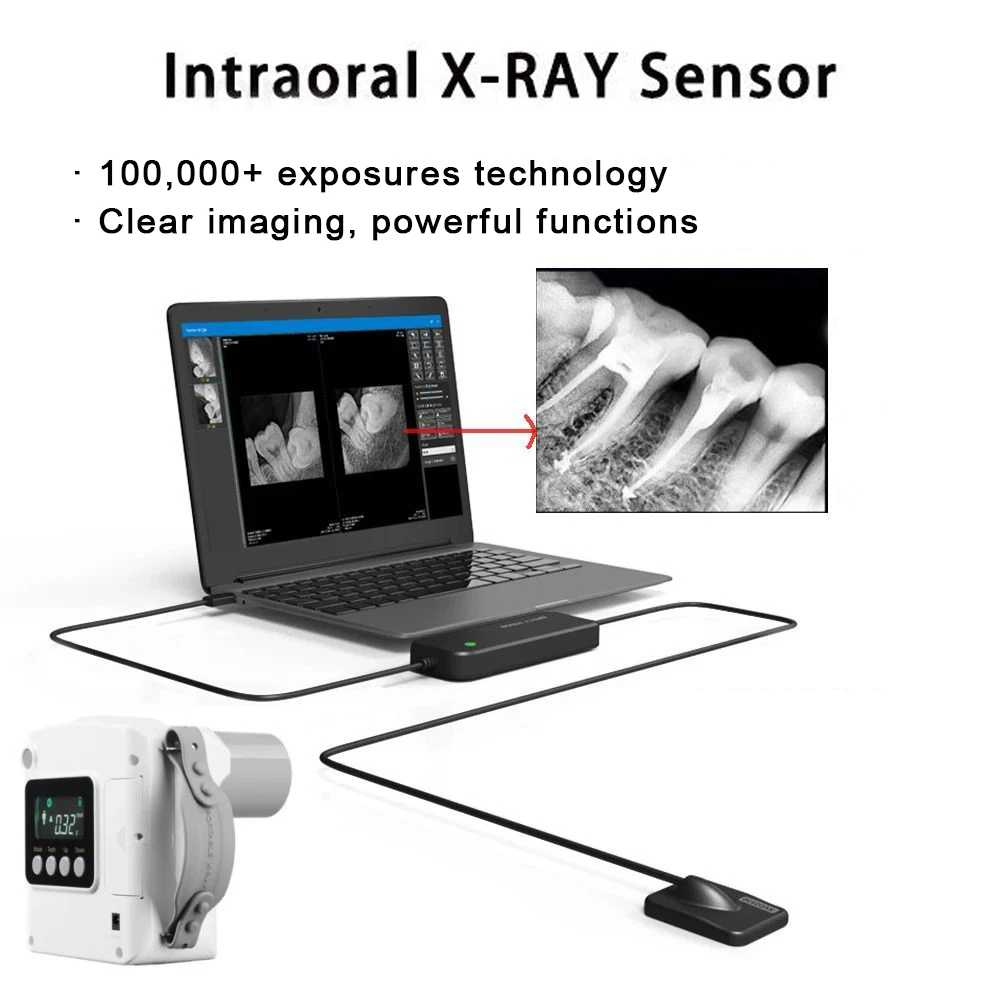 Dental Digital RVG Sensor HD Image Portable RX Intraoral X Ray Sensor Dentistry Tools  Radiovisiograph with Software