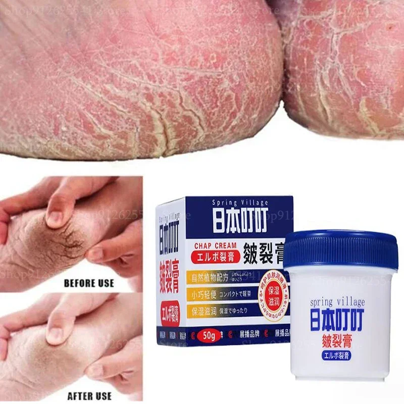 50g Anti Freezing Anti-Drying Crack Foot Cream for Removing Dead Skin and Dry Heels Hand and Foot Protection Cream