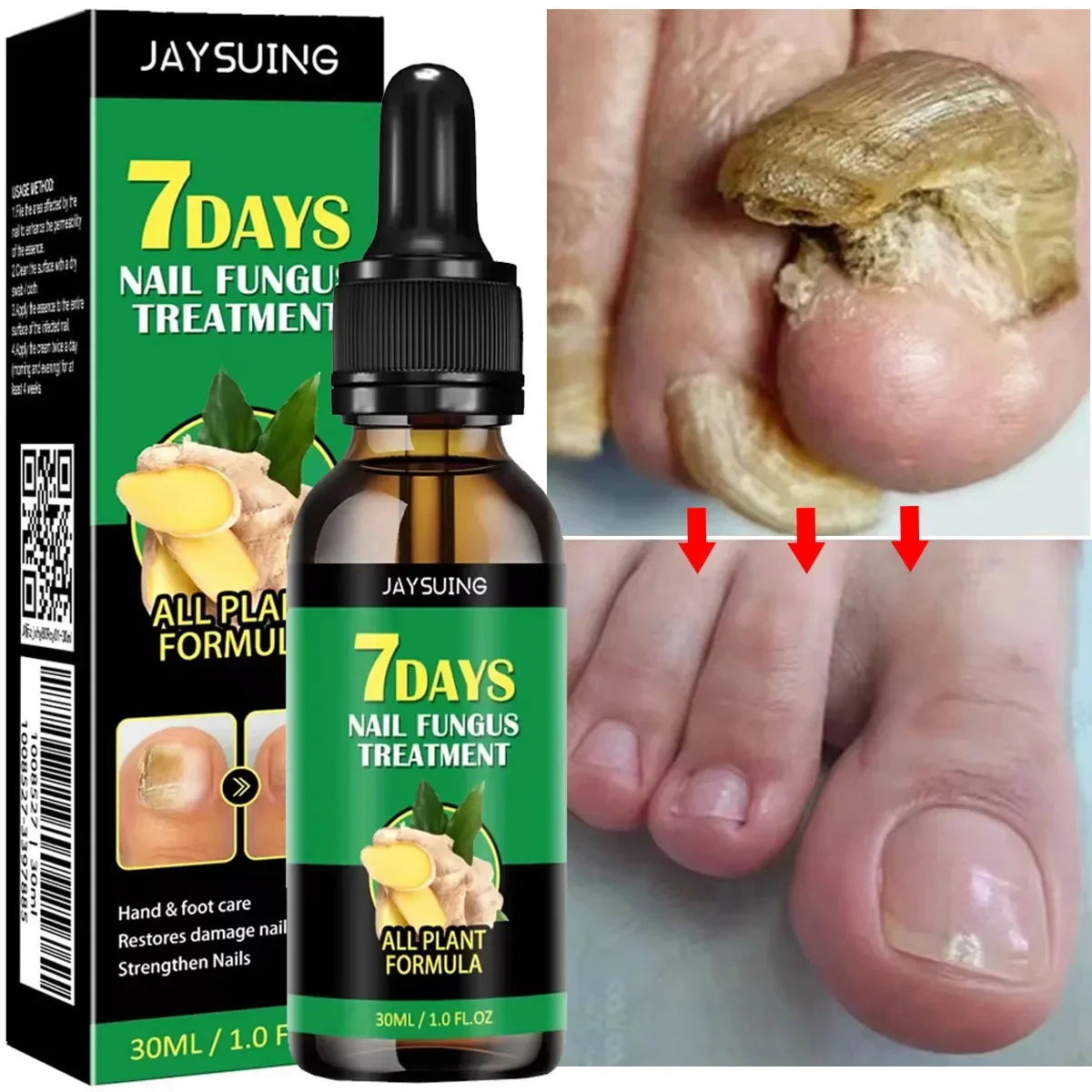 Nail Fungal Treatment Serum Foot Toe Nail Fungus Removal Anti Infection Onychomycosis Paronychia Repair Care Essential Oil