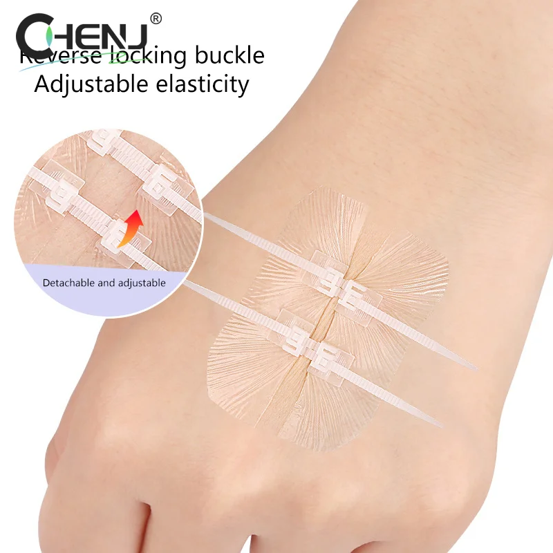 Zipper Tie Wound Closure Patch Zipper Band-Aid Wound Fast Suture Outdoor Portable Hemostatic Patch First Aid Tool