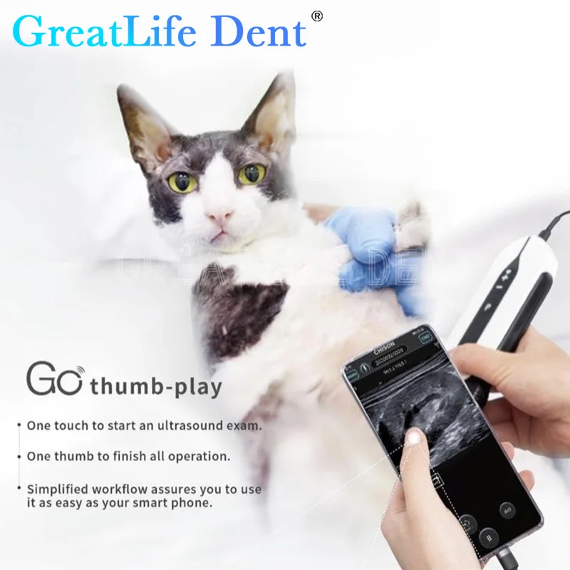 GreatLife Dent SonoEye P1 P2 P3 P5 P6 Portable Cardiac Micro-Convex Handheld Ultrasound Scanning Machine &Digital Examine System