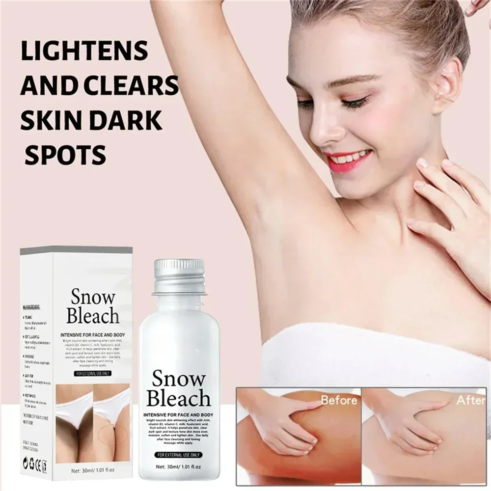 Whitening Cream Private Parts Underarm Bleaching Serum Whiten Butt Knee Brighten Intimate Parts Dark Remove Melanin