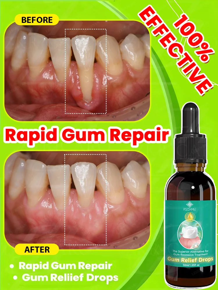 

Eᴀsɪʟʏ ʀᴇɢᴇɴᴇʀᴀᴛᴇ ɢᴜᴍs ᴀɴᴅ ᴄᴏᴠᴇʀ ᴛᴇᴇᴛʜ ɪɴ 7 ᴅᴀʏs