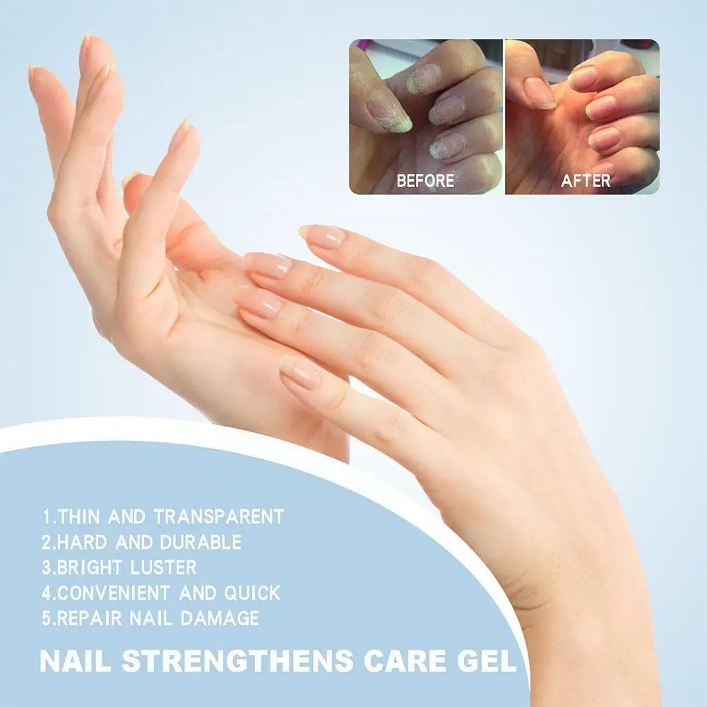 Nagelverzorging Gel Hand En Voet Onychomycosis Zachte Nagel Nagel Verheldering Nagel Verdikking Reparatie Behandeling Gel R0g2