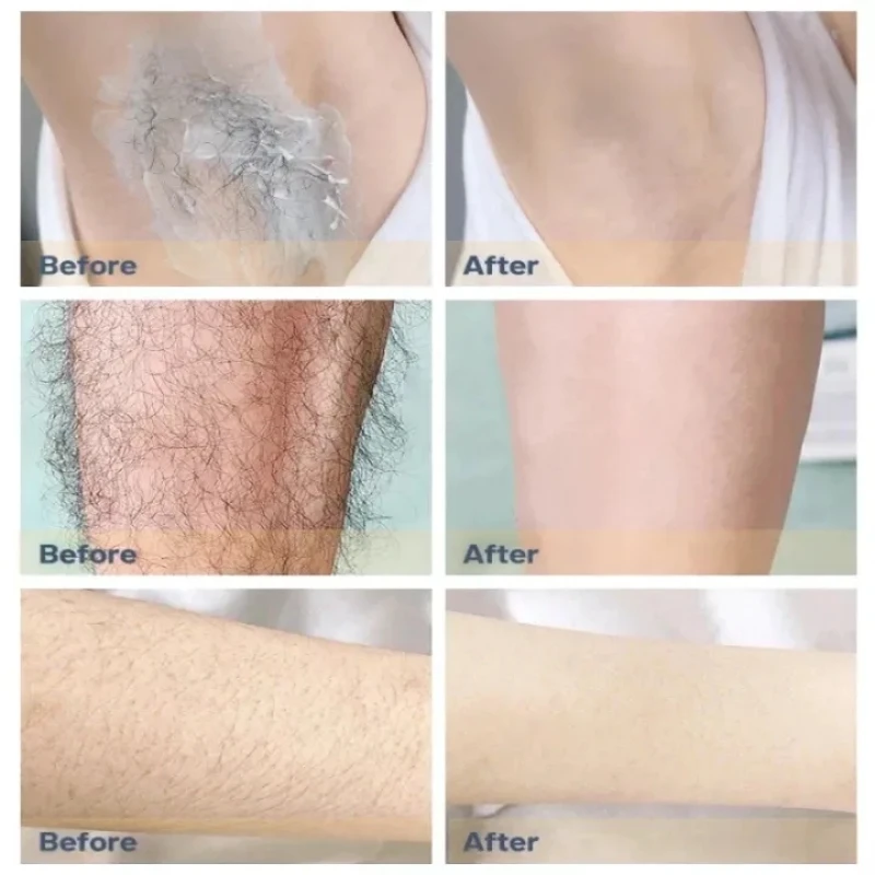 Permanent Hair Removal Cream Set For Men Women Body Face Intimate Areas Painless Hair Growth Inhibitor Depilatory Sooth SkinCare