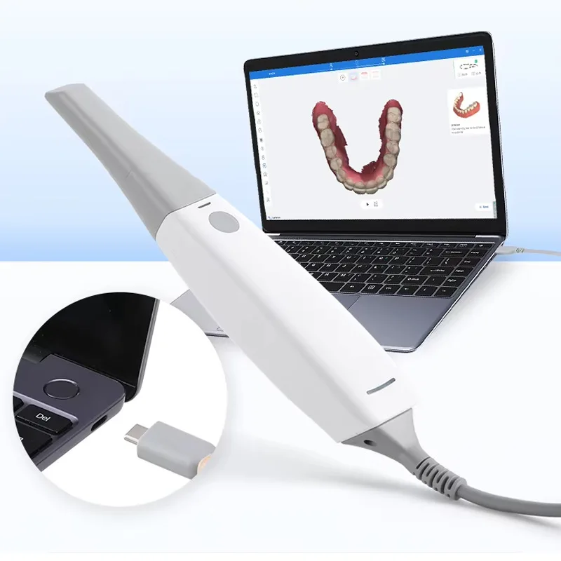 Dental Oral Scanner 3D Digital Impression Machine S6500 3D Scanner Orthodontic Repair