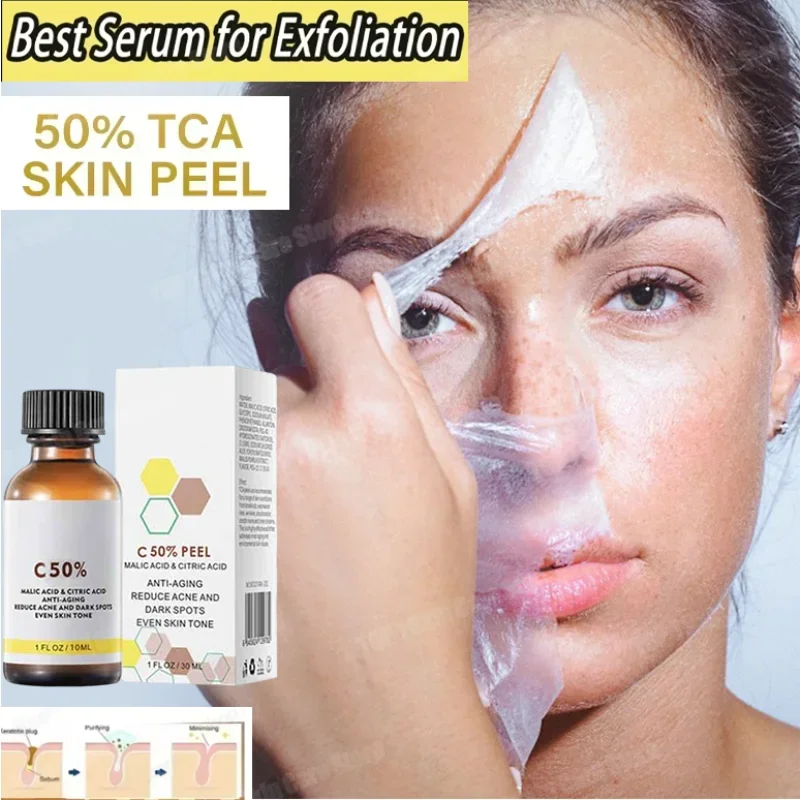 

Peeling Serum Bleaching Dark Skin Spots Remove Dead Skin Melanin Scrub Exfoliating Whiten Moisturize Skin Rejuvenating Essence