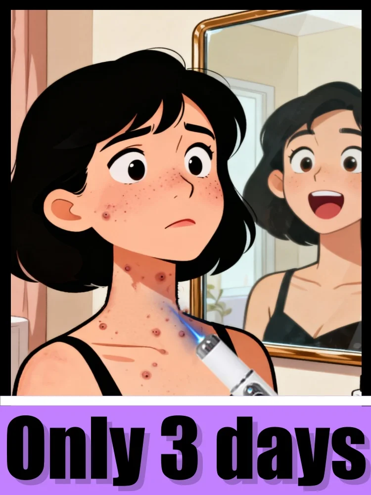 Bolígrafo unisex con luz azul: ¡consulte un furtivo en nuestra herramienta para el cuidado de verrugas! Lote limitado disponible.