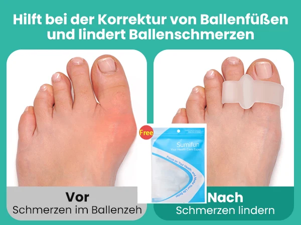 

2/4/6/10Pcs Gel White Double Hole Toe Separator Hallux Valgus Toe Overlap Correction Bunion Foot Care Tool Orthopedics Corrector