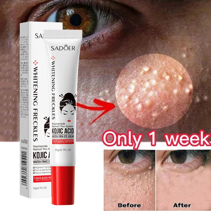 Fat Granules Remover Eye Cream Anti-puffiness Anti Inflammatory Firm Cream Reduce Dark Circles Fade Fine Lines Repair Barrier