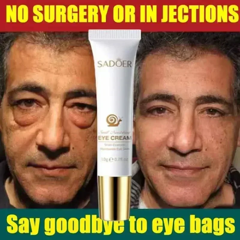 Instant Eye Bag Removal Cream Collagen Removal Wrinkles Lifting Fade Fine Lines Moisturizing Brightening Anti Puffiness Eye Care