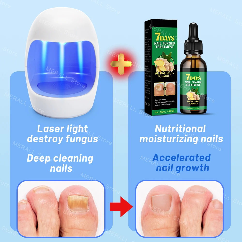 Fungal Nail Laser Device Repair Fast Nails Fungus Onychomycosis Anti Thyroiditis Relief Pure Natural Oil Foot Care Beauty Health