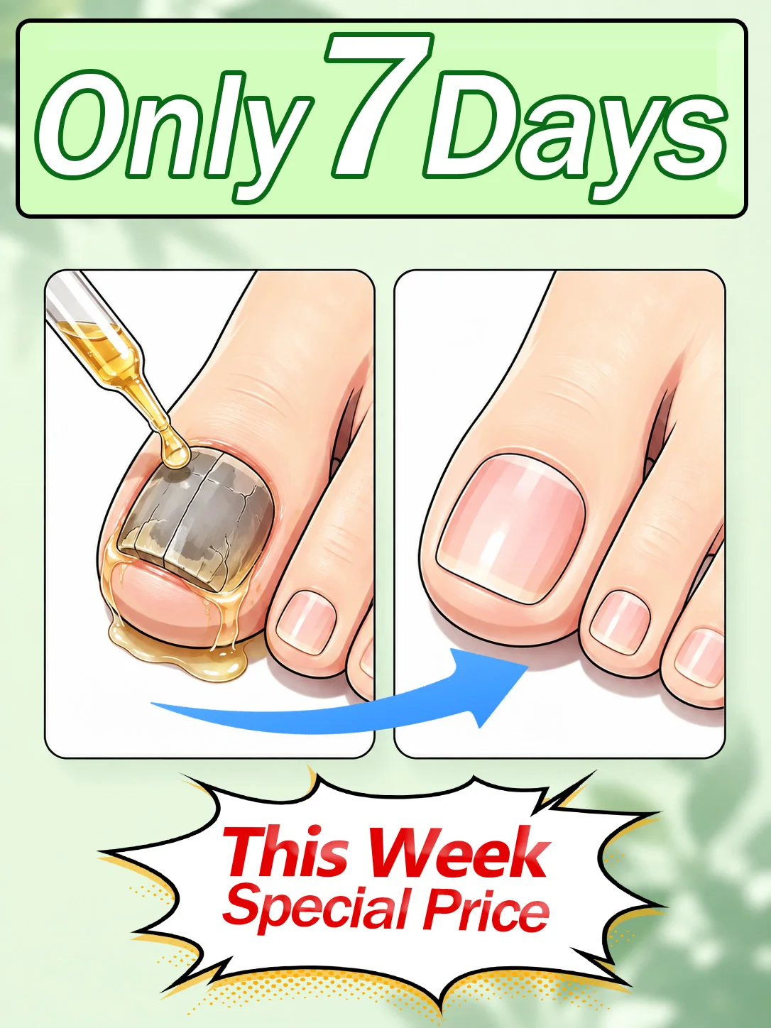 Premium Nail Nourish Care Solution, Gentle Home Use Formula, Improves The Appearance of Weak, Discolored and Uneven Nails