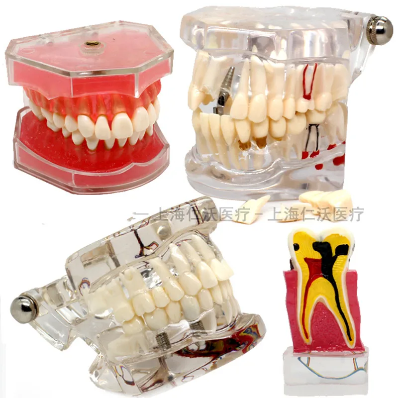 Various dental models for teaching and hospital dental materials