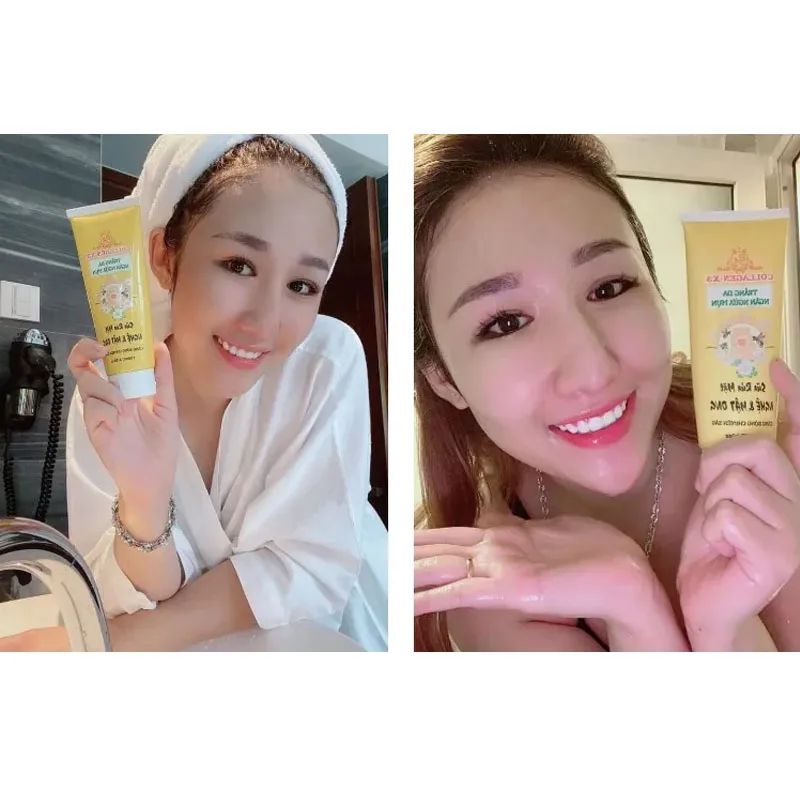 Sữa rửa mặt Collagen X3 nghệ mật ong mỹ phẩm Dong Anh 正規品 美白肌、ニキビ予防、ニキビ除去美白肌 100ml
