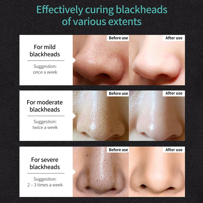 قناع مزيل الرؤوس السوداء تقليص المسام التنظيف العميق قناع ترطيب تحسين مسام الجلد الخام تقشر قناع الطين العناية بالبشرة