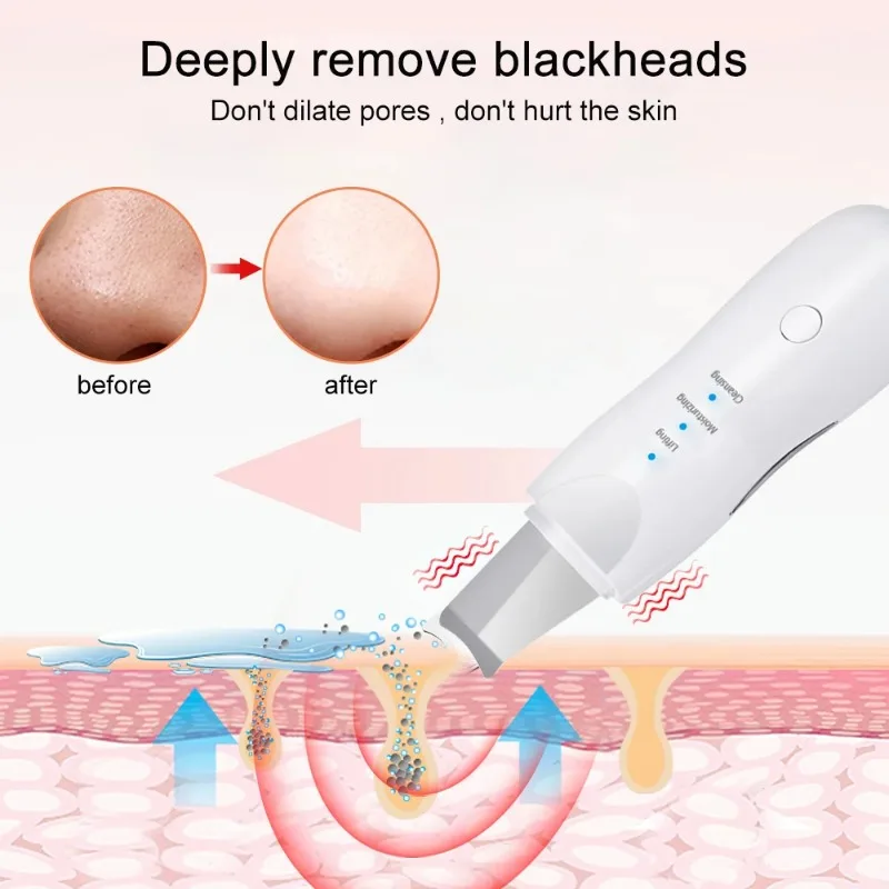 Ultrasone Mee-Eter Schep Huid Scrubber Peeling Mee-Eter Verwijderaar Diepe Reiniging Gezicht Porie Zwarte Kop Acne Schoonheidsapparaten Tool