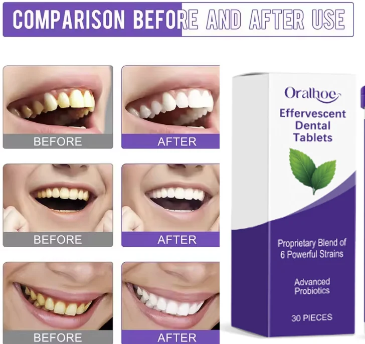 

Mint Flavors Toothpaste Tablets Whitening Dental Improve Bad Breath Remove Smoke Stain Fresh Mouth Oral Hygiene Solid Toothpaste