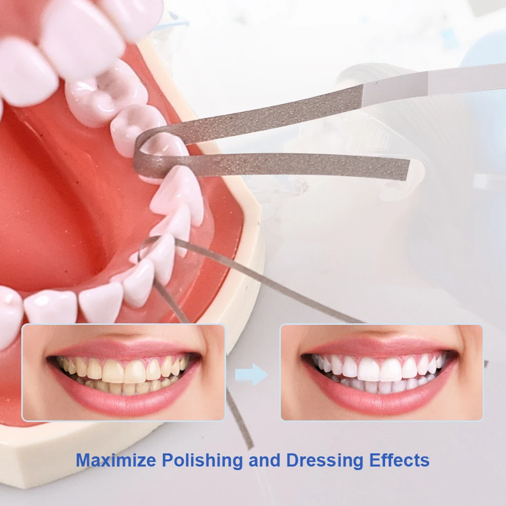 40Pcs Dental Polishing Strips for Interproximal Application Finishing and Polishing Polish Strip Dental Lab Polishing Materials