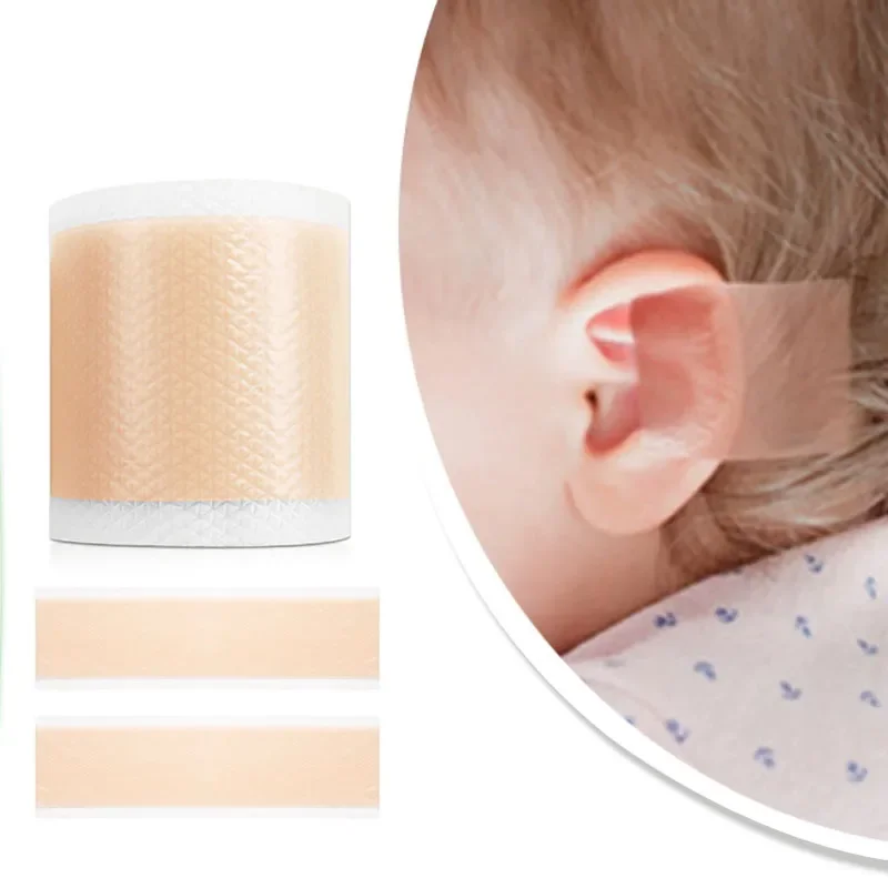 4x50cm Silicone Kids Baby Ear Corrector Infant Protruding Ears Correction Ear Aesthetic Correctors Patch Sticker