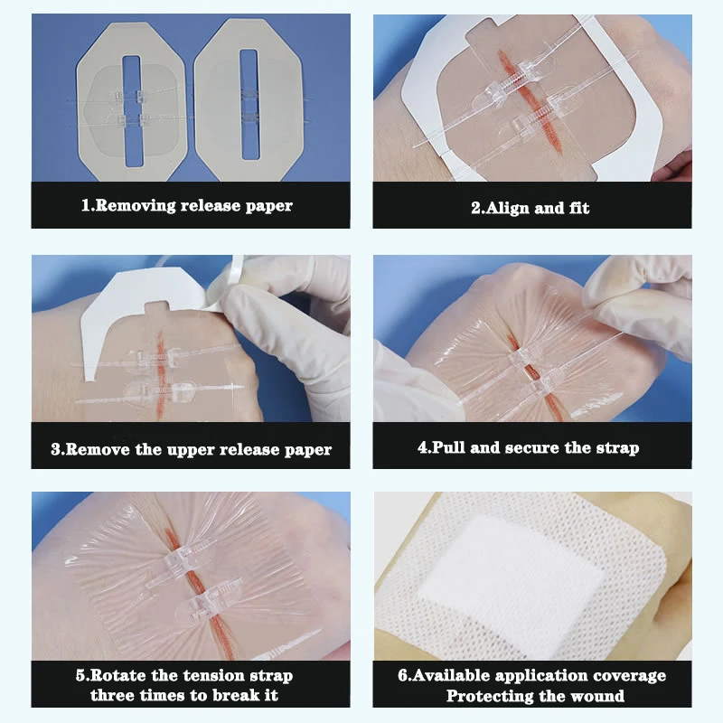 Zipper Band-aid Painless Wound Closure Device Suture-free Wound Dressing Patches Zip Suture Reducer Band Aid