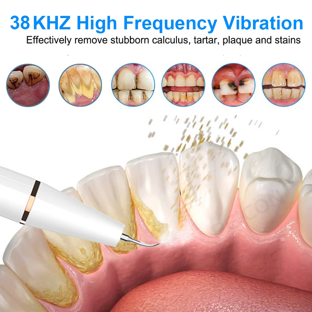 Xiaomi Ultrasonic Dental Scaler For Teeth Tartar Stain Tooth Calculus Remover Electric Teeth Plaque Cleaner Dental Stone Removal