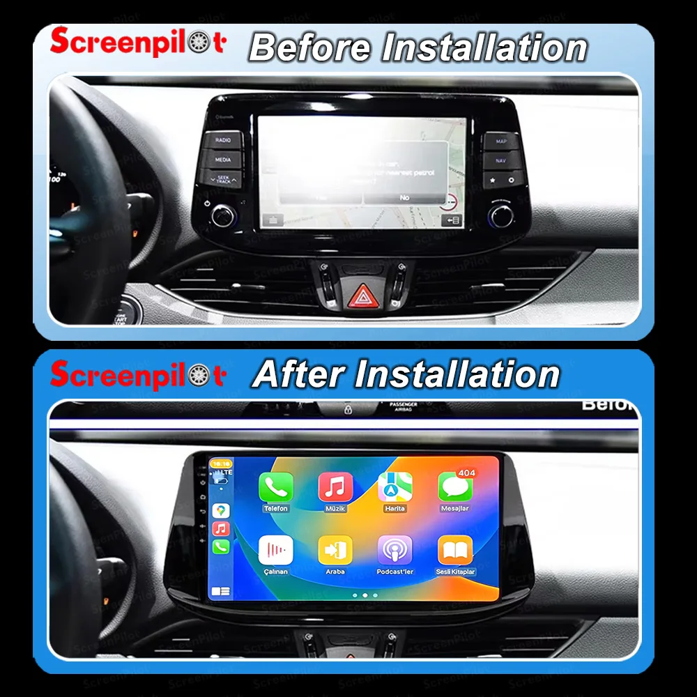 Android16 Auto Car Radio For Hyundai i30 2017 2018 2019 2020 2021 Stereo Multimedia Player 2 din GPS Screen Carplay 2K QLED