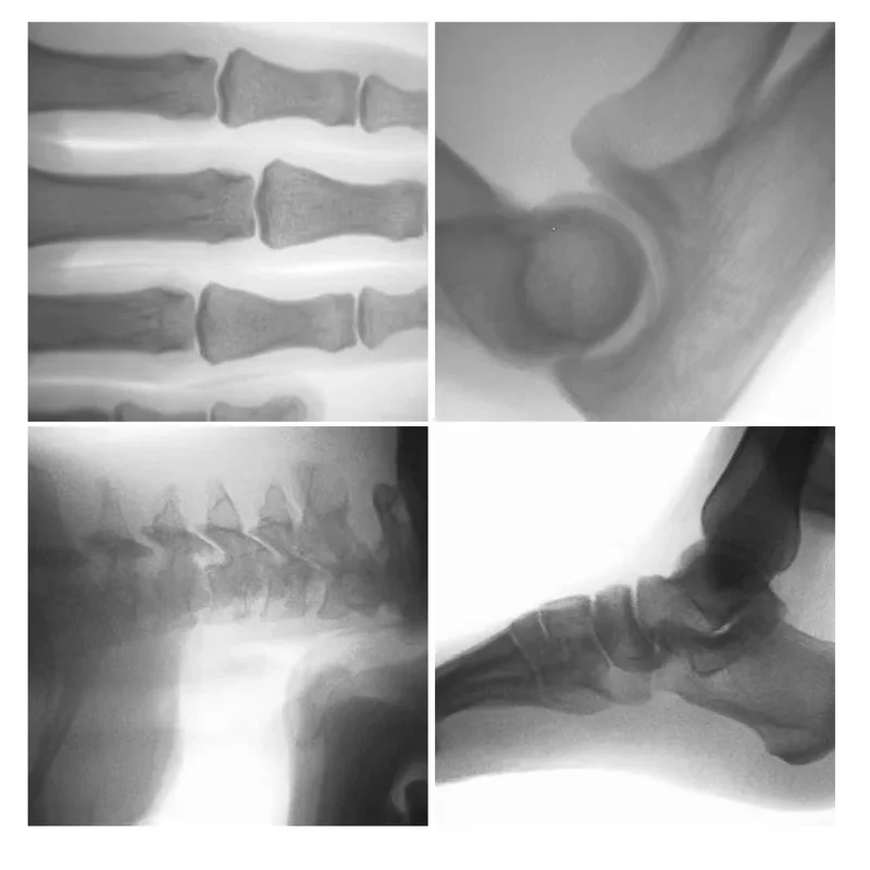 small C arm X-ray machine/ portable fluoroscopy radiography with large screen