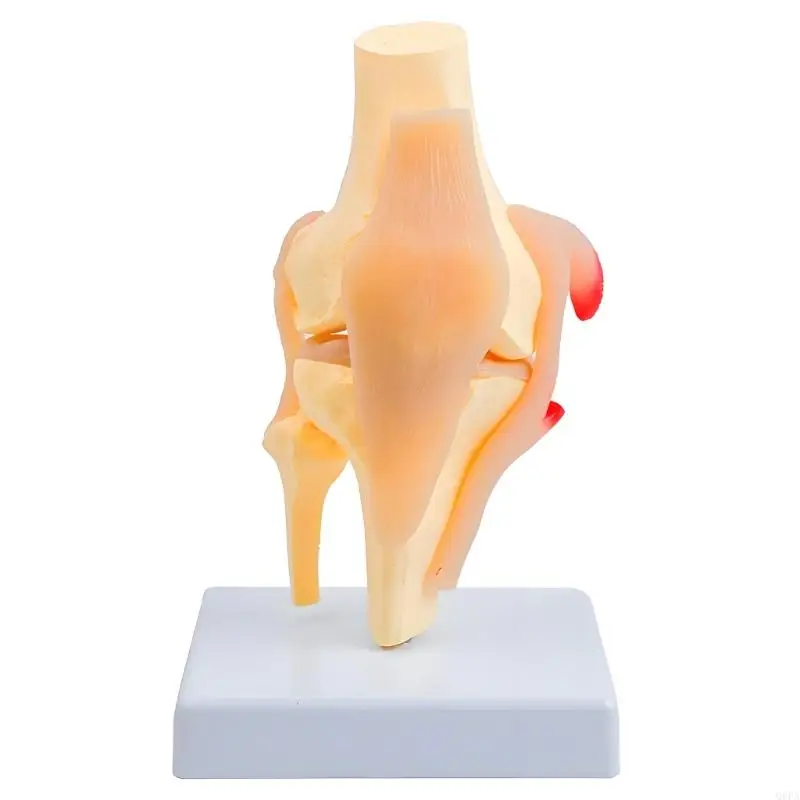 

Q6PA Anatomical Knee Joint Structure Model PVC Patella Knee Joint Anatomy Model For Clinical Training Patient Communication