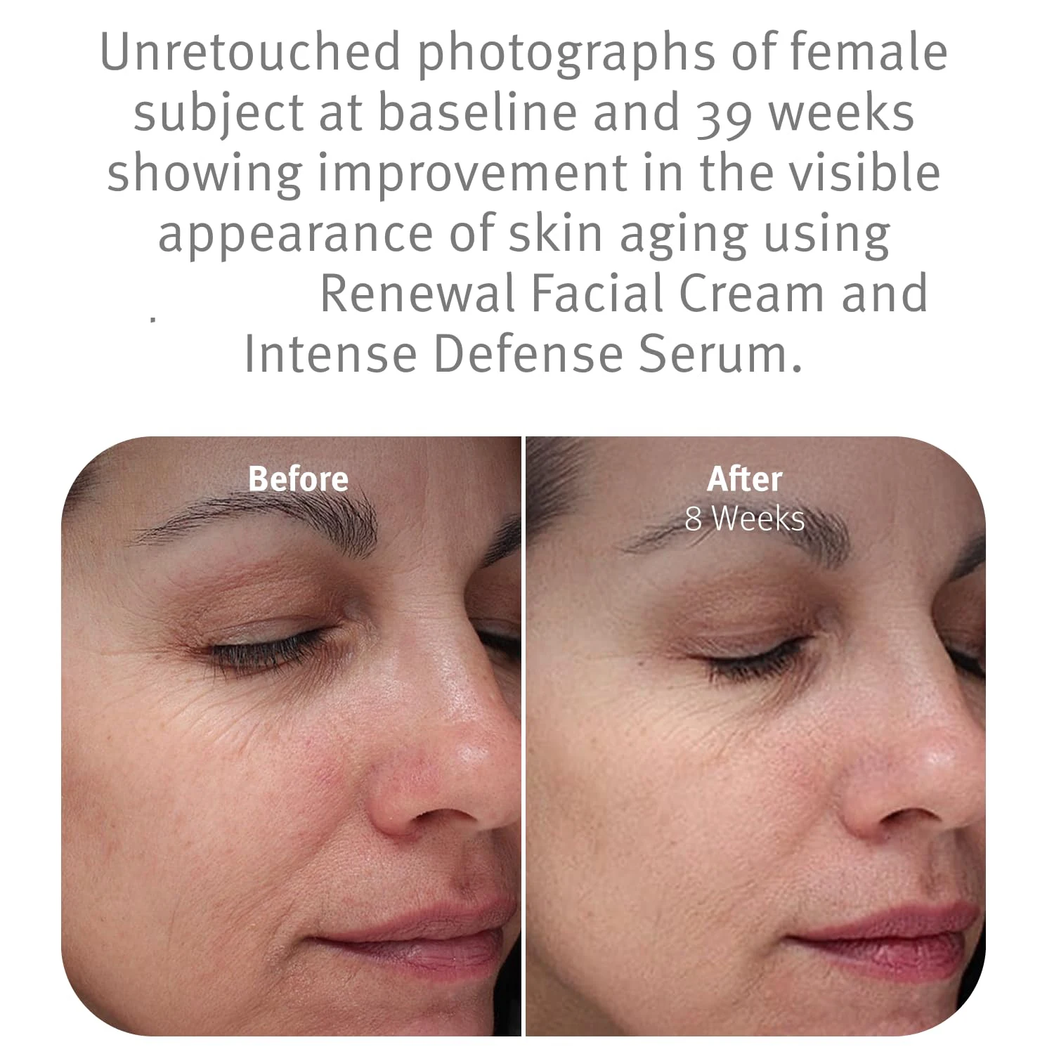 Sponge bone Needle Firming Anti-Wrinkle, Youthful Face Microcrystalline Cream Lifting, Reducing wrinkles,  Moisturizing cream