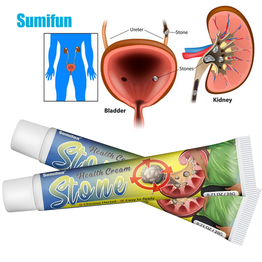 

20G Sumifun Kidney Stones Removal Cream Urolithiasis Body Detox Plaster Treat Gallstones Renal Calculus Medical Herbal Ointment