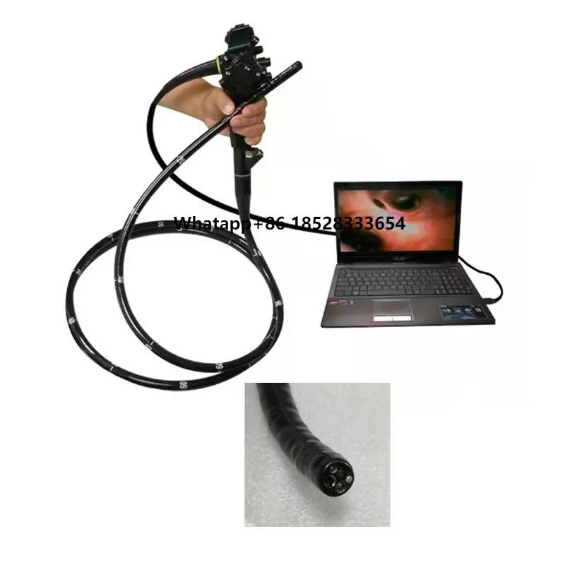 

Hot Selling Portable Flexible USB Video Gastroscope And Video Colonoscope Olympus